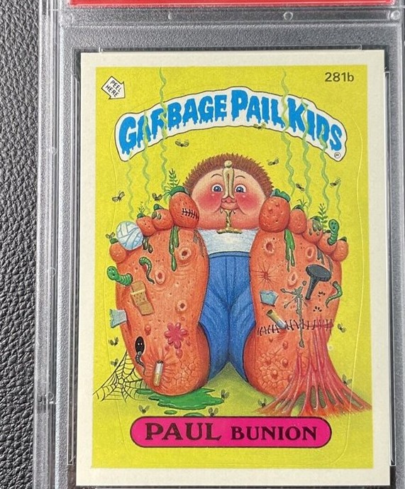 Paul Bunion